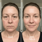 Silva - Brosse de massage lymphatique